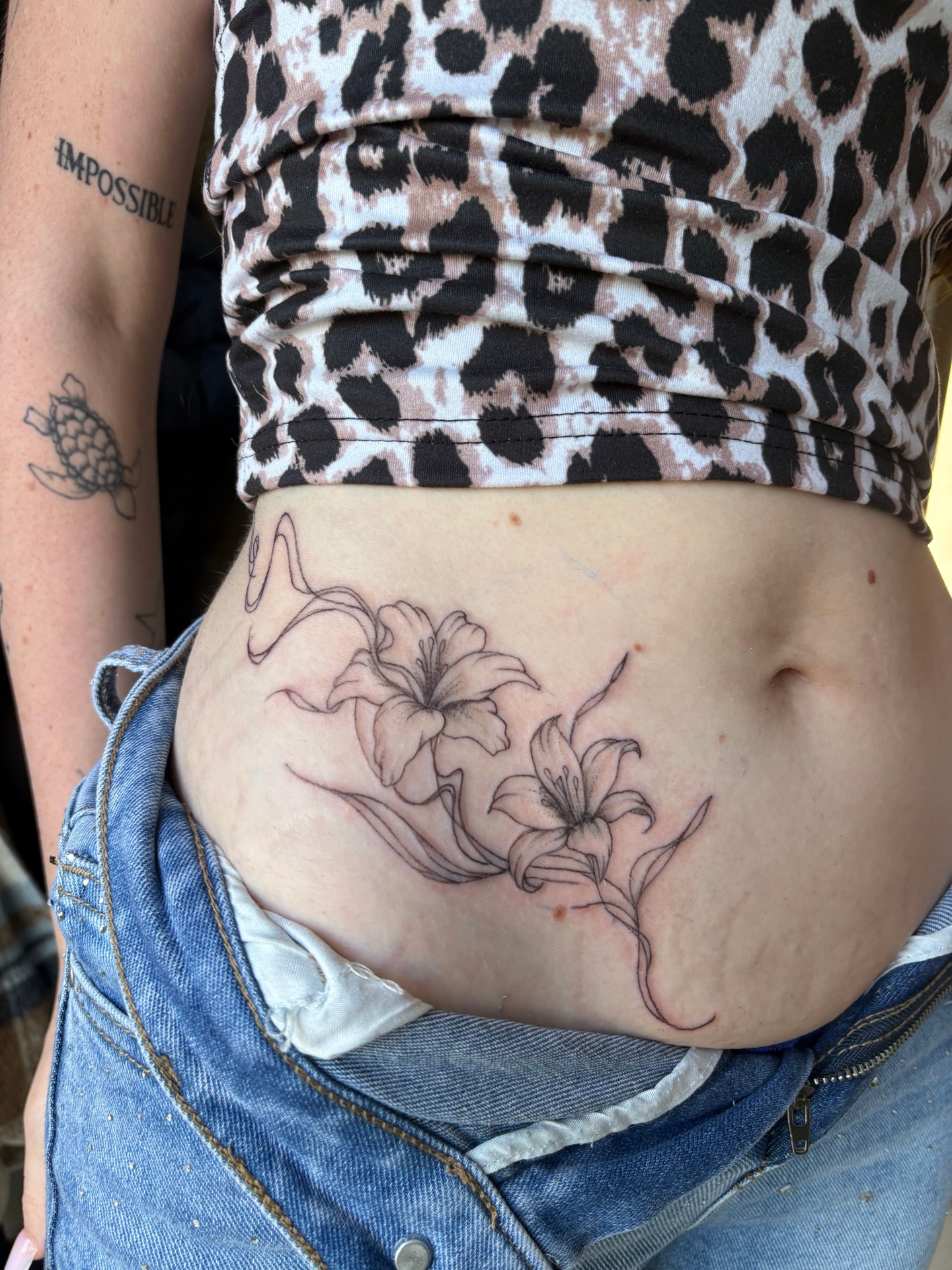 Réalisme botanique — bras